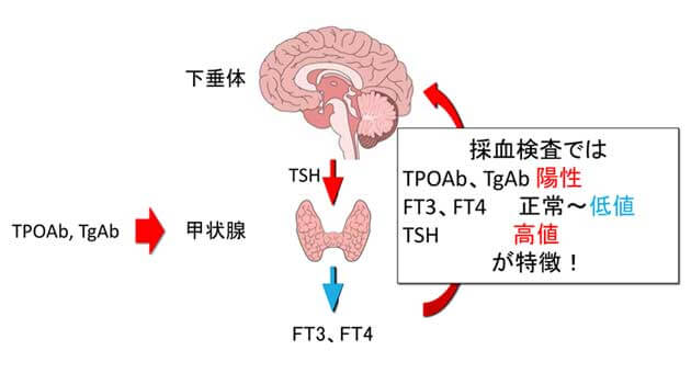 橋本病での甲状腺のホルモンの動き